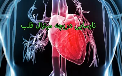 نارسایی دریچه میترال
