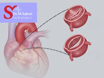 تشخیص بیماری های دریچه قلب