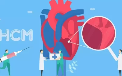 کاردیومیوپاتی هیپرتروفیک (HCM) چیست؟ نحوه تشخیص و درمان آن