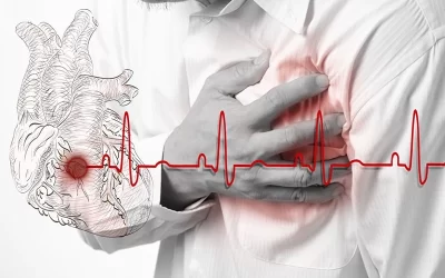 هنگام سکته قلبی چه کنیم؟